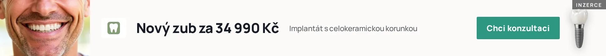 Inzerce Dostupné implantáty: nový zub za 34 990 Kč, německý implantát s celokeramickou korunkou