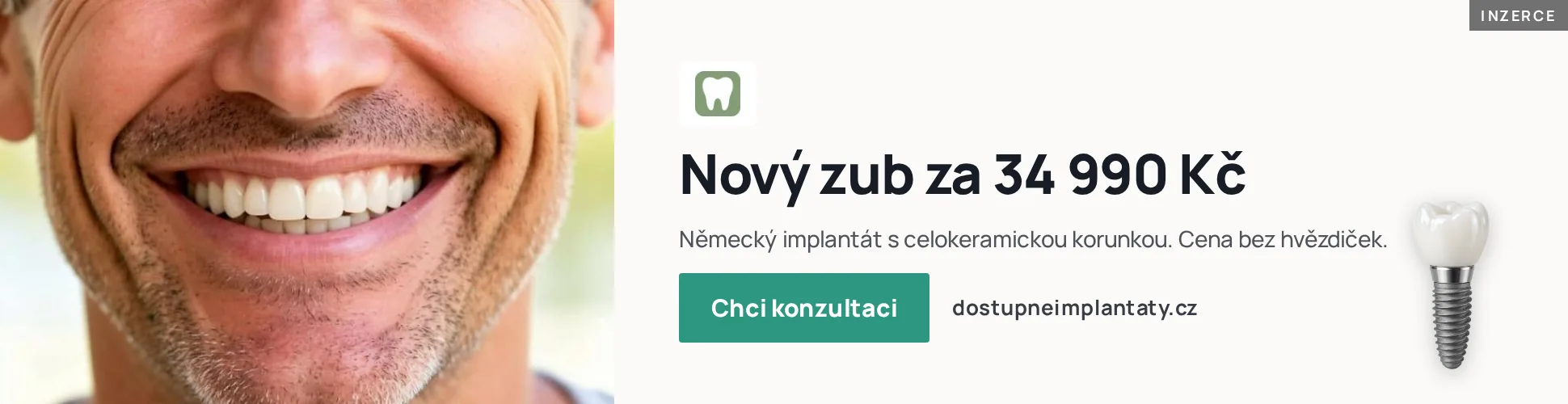 Inzerce Dostupné implantáty: nový zub za 34 990 Kč, německý implantát s celokeramickou korunkou